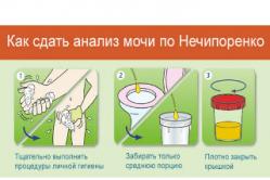 Cara mengumpulkan tes urine menurut Nechiporenko, apa yang ditunjukkannya, menguraikan hasilnya