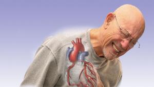Cardiopatía isquémica (CC): síntomas, causas, tipos y tratamiento de la CI